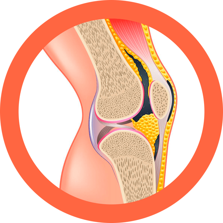 Hondroten – taastab liigesed ja lihased